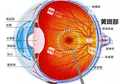 黃斑病變是怎么回事能治好嗎?黃斑病變不治療會怎么樣？